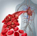 CURSO ANTICOAGULACIÓN PARA ENFERMERÍA DE FAMILIA